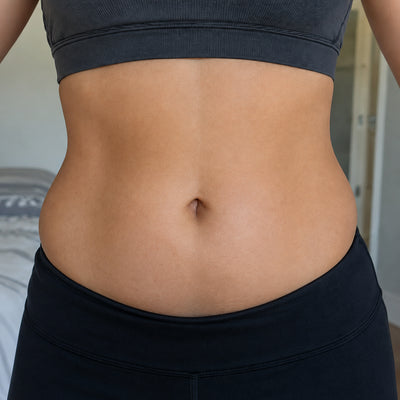 Foto de Carolina L. antes de su transformación